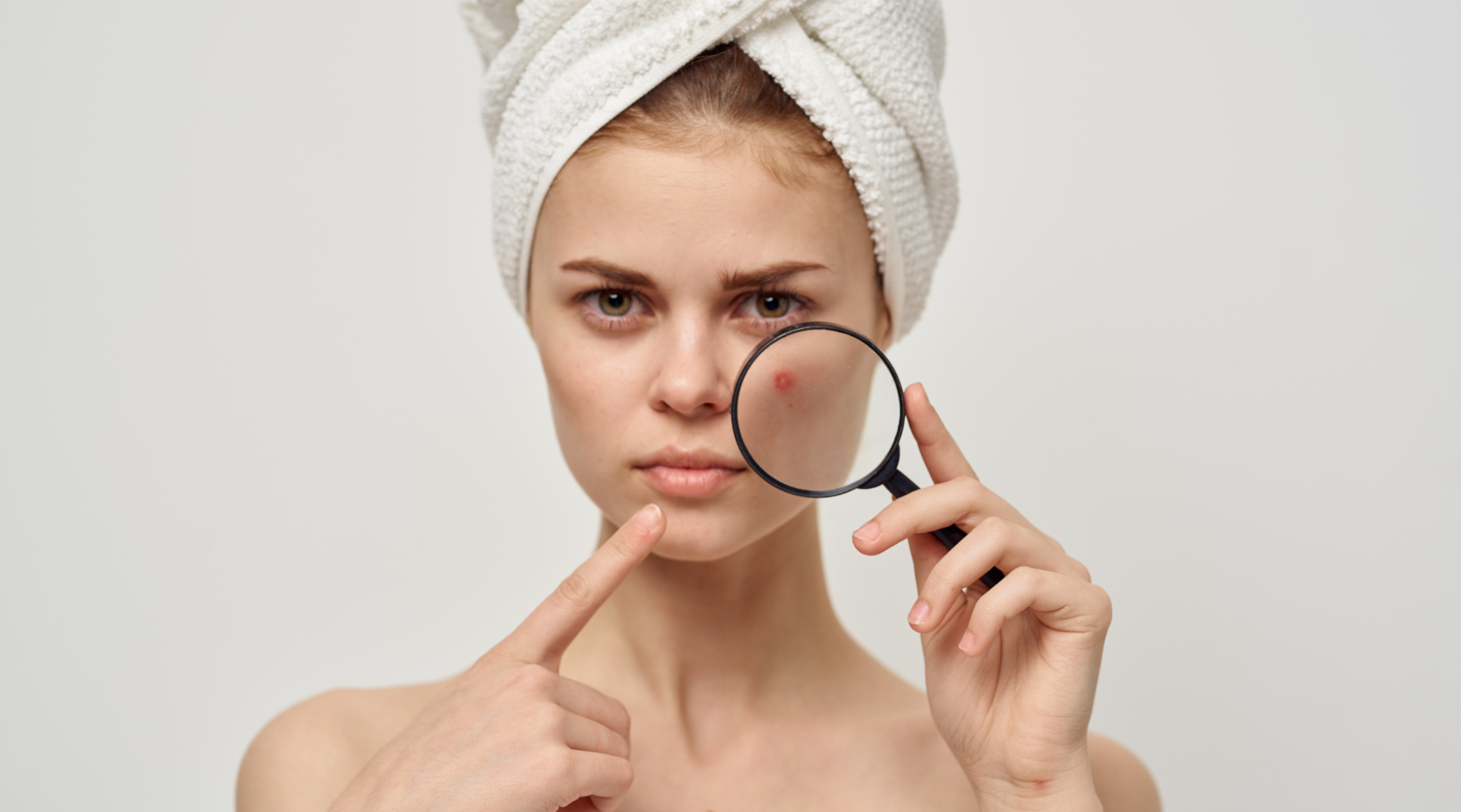 Zinc and Acne: Could This Mineral Be Your Skin’s Secret Weapon?