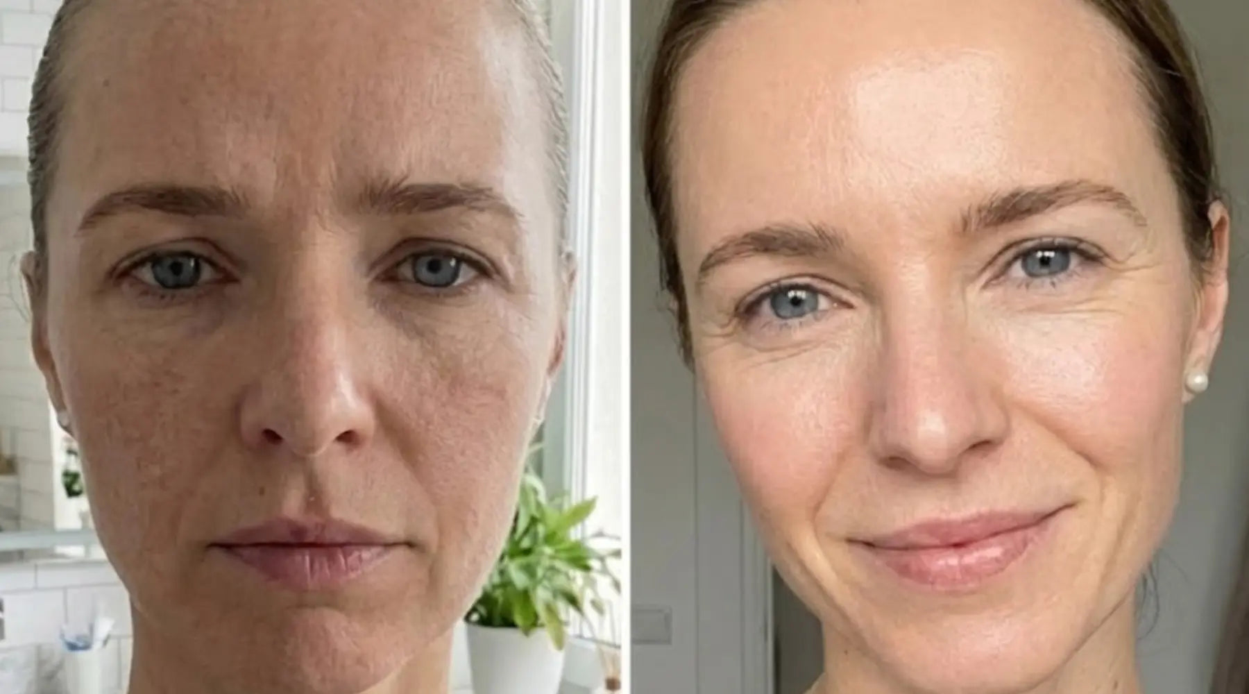 Ultimate Skincare BNDL Advert